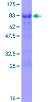 12.5% SDS-PAGE Stained with Coomassie Blue.